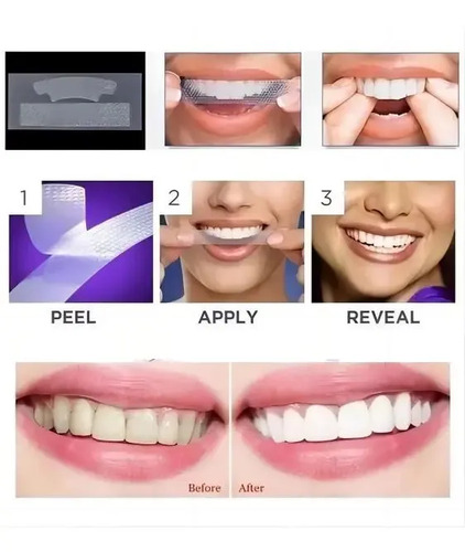 Tiras Blanqueadoras Advanced Teeth Whitening Strips 28 Unid. 5